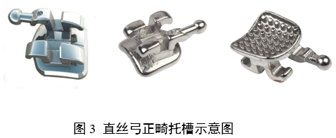 正畸托槽注冊(cè)審查指導(dǎo)原則（2022年第41號(hào)）(圖3)